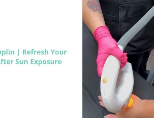 IPL in Joplin, MO: Refresh Your Skin After Sun Exposure